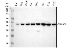 Western blot analysis of DAZAP1 using anti-DAZAP1 antibody (ABIN6719309).