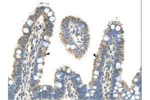 Image no. 1 for anti-Pannexin 1 (PANX1) (AA 231-280) antibody (ABIN6736329) (PANX1 antibody  (AA 231-280))