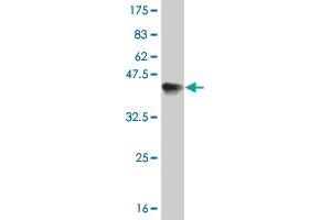 Western Blot detection against Immunogen (36. (ERN1 antibody  (AA 401-500))