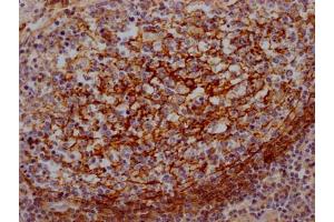 IHC image of ABIN7127406 diluted at 1:100 and staining in paraffin-embedded human lung tissue performed on a Leica BondTM system. (Recombinant CD55 antibody)