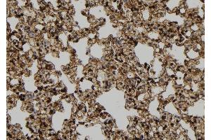 ABIN6278961 at 1/100 staining Rat lung tissue by IHC-P. (Cyclin B2 antibody  (Internal Region))