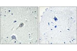 Immunohistochemistry analysis of paraffin-embedded human brain tissue, using CNR1 Antibody.