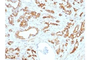 Formalin-fixed, paraffin-embedded human Prostate stained with Aurora B Mouse Monoclonal Antibody (AURKB/1593). (Aurora Kinase B antibody  (AA 89-251))