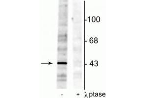 Western blot of rat testes lysate showing specific immunolabeling of the ~46 kDa EphrinB phosphorylated at Tyr298 in the first lane (-). (EPH Receptor B2 antibody  (pTyr298))