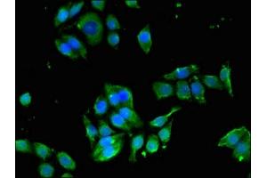 Immunofluorescent analysis of PC-3 cells using ABIN7151760 at dilution of 1:100 and Alexa Fluor 488-congugated AffiniPure Goat Anti-Rabbit IgG(H+L) (EDNRB antibody  (AA 27-101))