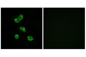 Immunofluorescence analysis of MCF-7 cells, using CA5B antibody. (CA5B antibody  (C-Term))