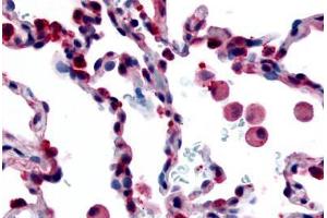 Human Lung, Alveolar Macrophages (formalin-fixed, paraffin-embedded) stained with FFAR2 antibody ABIN213512 at 35 ug/ml followed by biotinylated goat anti-rabbit IgG secondary antibody ABIN481713, alkaline phosphatase-streptavidin and chromogen. (FFAR2 antibody  (Extracellular Domain))