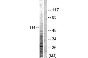 Western Blotting (WB) image for anti-Tyrosine Hydroxylase (TH) (Ser19) antibody (ABIN1847900) (Tyrosine Hydroxylase antibody  (Ser19))