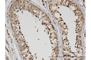 Immunoperoxidase of monoclonal antibody to SLC13A5 on formalin-fixed paraffin-embedded human testis. (SLC13A5 antibody  (AA 152-206))