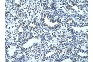 Human Lung; . (IKZF4 antibody  (N-Term))