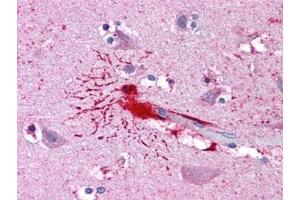 Human Brain, Cortex: Formalin-Fixed, Paraffin-Embedded (FFPE) (LHX8 antibody)