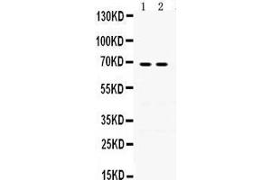 Western Blotting (WB) image for anti-Involucrin (IVL) (AA 551-585), (C-Term) antibody (ABIN3042470) (Involucrin antibody  (C-Term))
