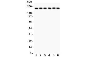 Western blot testing of PAPP-A antibody and human samples 1:  placenta;  2: HT1080;  3: SKOV;  4: 22RV1;  5: SW620;  6: MM231 lysate. (PAPPA antibody  (AA 95-388))
