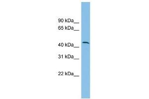 DPH1 antibody used at 1 ug/ml to detect target protein. (DPH1 antibody)