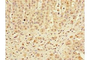Immunohistochemistry of paraffin-embedded human adrenal gland tissue using ABIN7166660 at dilution of 1:100 (DHX3 (AA 694-1000) antibody)