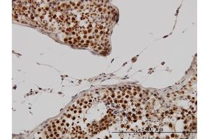 Immunoperoxidase of monoclonal antibody to CCNH on formalin-fixed paraffin-embedded human testis.