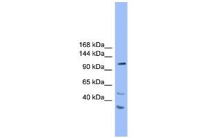 WB Suggested Anti-STARD8 Antibody Titration: 1. (STARD8 antibody  (N-Term))