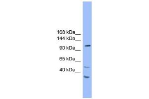 WB Suggested Anti-STARD8 Antibody Titration: 1. (STARD8 antibody  (N-Term))