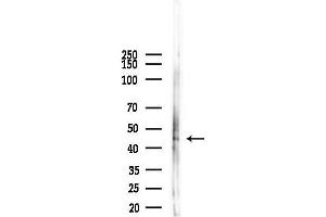 anti-Neutrophil Cytosol Factor 1 (NCF1) (pSer345) antibody