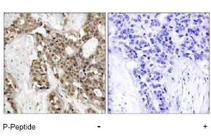 Image no. 1 for anti-Mitogen-Activated Protein Kinase 1/3 (MAPK1/3) (pThr187), (pTyr204) antibody (ABIN197000) (ERK1/2 antibody  (pThr187, pTyr204))