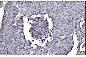 IHC analysis of SLFN11 using anti-SLFN11 antibody (ABIN7599761). (SLFN11 antibody  (AA 114-794))