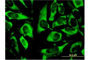 Immunofluorescence of monoclonal antibody to RPLP0 on HeLa cell. (RPLP0 antibody  (AA 1-317))