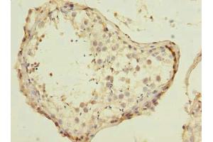 Immunohistochemistry of paraffin-embedded human testis tissue using ABIN7151602 at dilution of 1:100 (ESRG antibody  (AA 1-222))