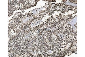 IHC analysis of REA/PHB2 using anti-REA/PHB2 antibody (ABIN7599239).