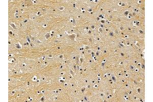 ABIN7094042 and ABIN7098086 at 1/100 staining mouse brain tissue by IHC-P. (Exportin 6 antibody  (N-Term))