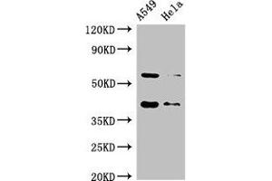 Western Blot Positive WB detected in: A549 whole cell lysate, Hela whole cell lysate All lanes: SMN1 antibody at 2 μg/mL Secondary Goat polyclonal to rabbit IgG at 1/50000 dilution Predicted band size: 32, 29, 31, 28 kDa Observed band size: 40, 60 kDa (SMN1 antibody  (AA 3-194))