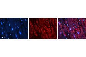 Rabbit Anti-PARD3 Antibody   Formalin Fixed Paraffin Embedded Tissue: Human heart Tissue Observed Staining: Cytoplasmic, plasma membrane in intercalated disc Primary Antibody Concentration: N/A Other Working Concentrations: 1:600 Secondary Antibody: Donkey anti-Rabbit-Cy3 Secondary Antibody Concentration: 1:200 Magnification: 20X Exposure Time: 0. (PARD3 antibody  (N-Term))