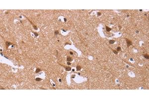 Immunohistochemistry of paraffin-embedded Human brain tissue using DCBLD2 Polyclonal Antibody at dilution 1:50 (DCBLD2 antibody)