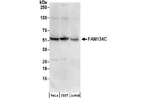 anti-Family with Sequence Similarity 134, Member C (FAM134C) (AA 416-466) antibody