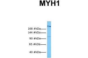 Host:  Rabbit  Target Name:  MYH1  Sample Tissue:  Human OVCAR-3  Antibody Dilution:  1. (MYH1 antibody  (N-Term))