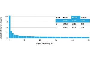 Analysis of Protein Array containing more than 19,000 full-length human proteins using Cytokeratin 15 Mouse Monoclonal Antibody (KRT15/2958). (KRT15 antibody)