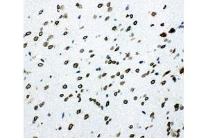 Immunohistochemistry (IHC) image for anti-SHC (Src Homology 2 Domain Containing) Transforming Protein 1 (SHC1) (C-Term) antibody (ABIN3032555)