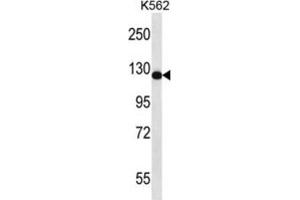 Western Blotting (WB) image for anti-RAS Protein Activator Like 2 (RASAL2) antibody (ABIN2997065) (RASAL2 antibody)