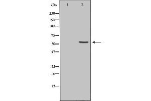 Western blot analysis of extracts from HeLa cells using ETV6 antibody. (ETV6 antibody  (Internal Region))