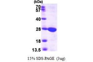 SDS-PAGE (SDS) image for Guanylate Kinase 1 (GUK1) (AA 1-197) protein (His tag) (ABIN667195) (GUK1 Protein (AA 1-197) (His tag))