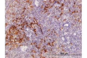 Immunoperoxidase of purified MaxPab antibody to TRAF1 on formalin-fixed paraffin-embedded human tonsil. (TRAF1 antibody  (AA 1-416))