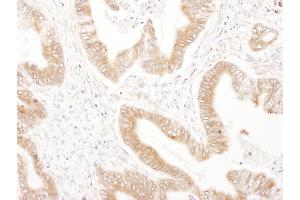 Immunohistochemistry (IHC) image for anti-Ribophorin II (RPN2) (AA 350-400) antibody (ABIN7455016) (Ribophorin II antibody  (AA 350-400))