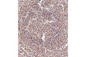 Immunohistochemical analysis of (ABIN657900 and ABIN2846851) on paraffin-embedded Human spleen tissue. (CD163L1 antibody  (C-Term))