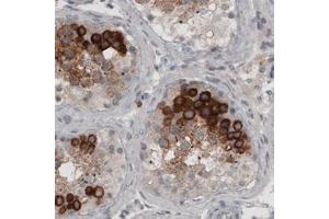 Immunohistochemical staining (Formalin-fixed paraffin-embedded sections) of human testis with LY6K monoclonal antibody, clone CL2435  shows strong cytoplasmic immunoreactivity in a subset of cells in seminiferous tubules. (Ly6k antibody)