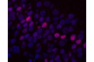 Immunofluorescence analysis of paraffin-embedded rat brain using c-Fos Monoclonal Antibody at dilution of 1:400. (c-FOS antibody)