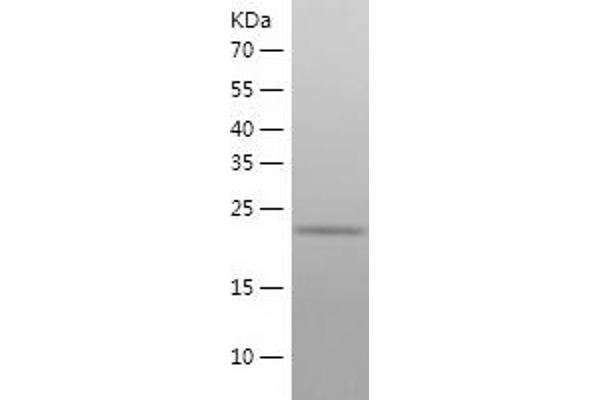 UBE2R2 Protein (AA 1-238) (His tag)