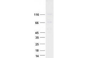 Validation with Western Blot (EVC Protein (Myc-DYKDDDDK Tag))