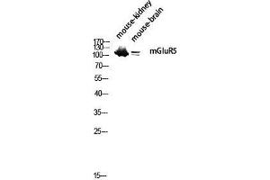 Western Blot (WB) analysis of Mouse Kidney Mouse Brain lysis using mGluR5 antibody. (Metabotropic Glutamate Receptor 5 antibody  (N-Term))