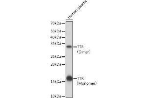 Western blot analysis of extracts of Human plasma, using TTR Rabbit mAb (ABIN1682449, ABIN3018489, ABIN3018490 and ABIN7101619) at 1:1000 dilution. (TTR antibody)