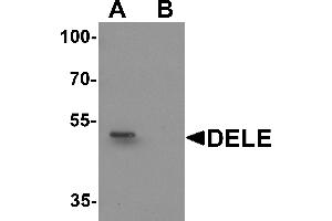Western blot analysis of DELE in rat brain tissue lysate with DELE antibody at 1 µg/mL in (A) the absence and (B) the presence of blocking peptide. (DELE1/KIAA0141 antibody  (N-Term))