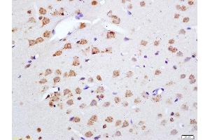 Formalin-fixed and paraffin embedded rat brain labeled with Anti-Phospho-Merlin(Ser518) Polyclonal Antibody, Unconjugated  at 1:200 followed by conjugation to the secondary antibody and DAB staining (Merlin antibody  (pSer518))